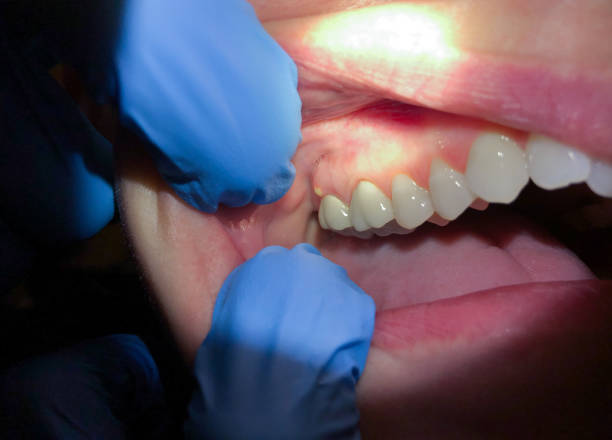 Best Emergency Denture Repair in Hawthorne, NV