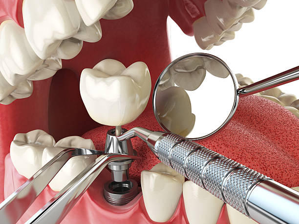 Best Emergency Gum Treatment in Hawthorne, NV